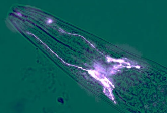 蠕虫研究表明脑细胞可以阻止肌肉萎缩