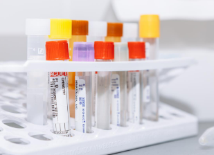 IKBFU科学家开发了用于抵抗智力障碍的酶的胶囊组合物