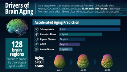 最大的大脑研究确定了大脑衰老的驱动力
