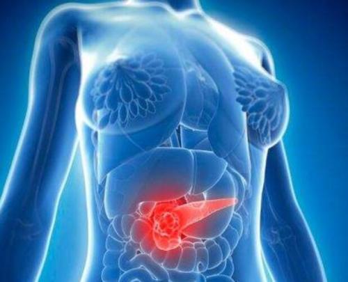 PARP抑制剂可以缩小具有特定突变的胰腺癌患者的肿瘤