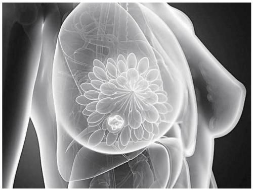 使用3D乳房X线照相术进行筛查时老年女性会受益匪浅