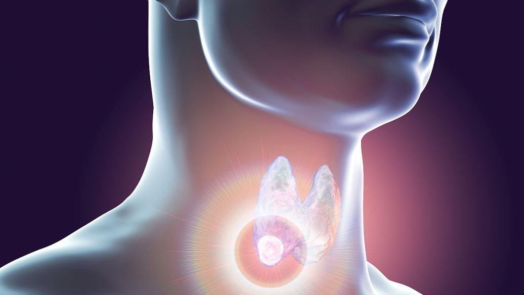 NIH研究表明NICU中的碘暴露可能导致甲状腺功能下降