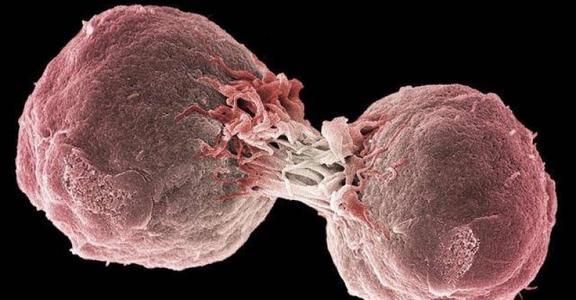 CNIO和Cabimer研究人员表明DNA拓扑问题可能导致淋巴瘤
