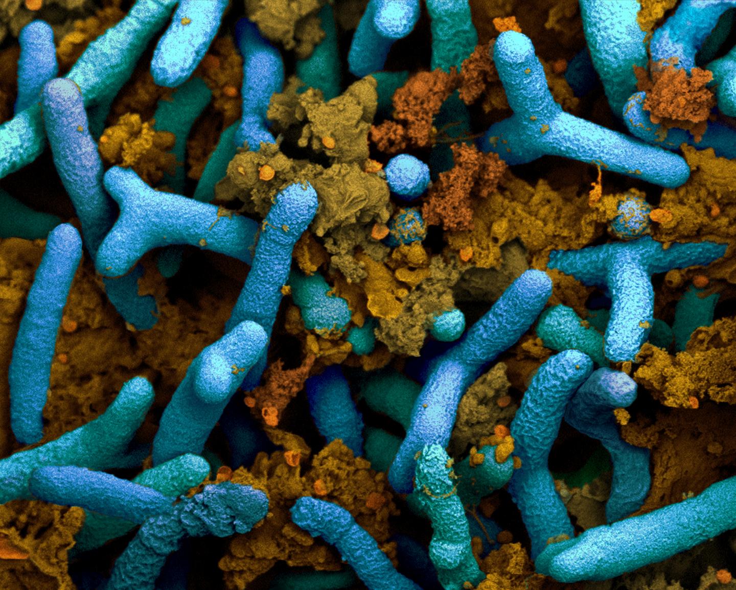 研究人与发现细菌如何使大豆受精