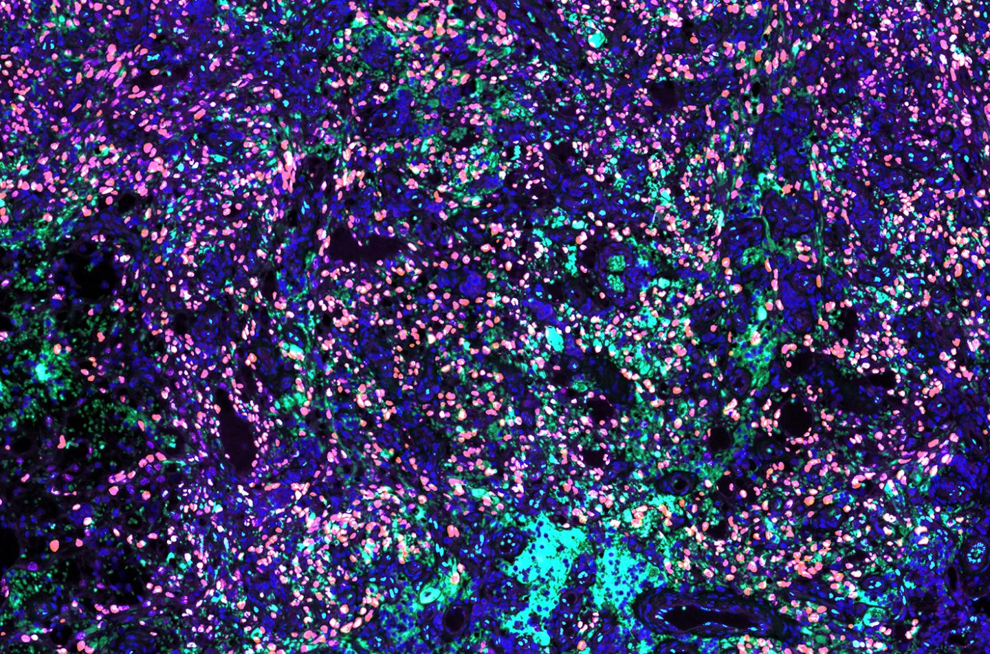 研究人员发现免疫细胞可以改善抗击乙型肝炎的能力