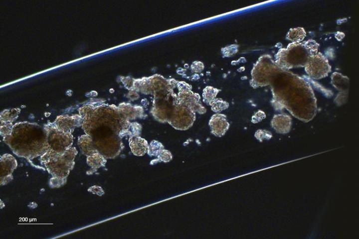 毫米厚载细胞的水凝胶纤维可改善糖尿病小鼠