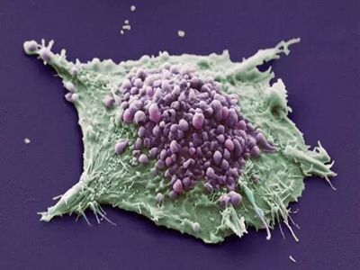 维持性免疫疗法未能改善广泛的小细胞肺癌的存活率