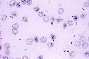 科普下肠球菌属的致病性是什么