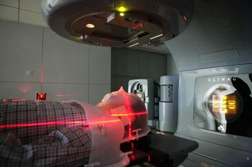 研究人员确定了预测和避免放射治疗副作用的方法