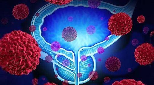 新的雄激素受体结构提示前列腺癌的治疗选择