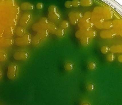 介绍下黄杆菌属培养的特性