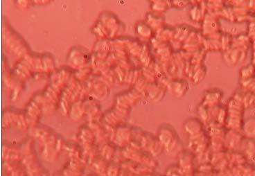 介绍下红细胞渗透脆性试验的原理和临床意义是什么