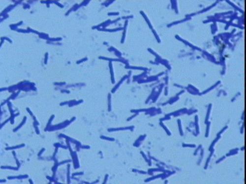 介绍下黄杆菌属的基本形态和染色