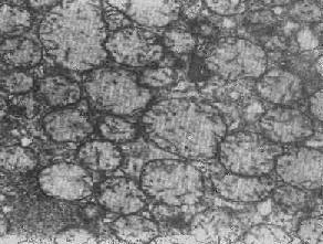 介绍下嗜碱性中幼粒细胞在电镜下的超微结构是什么