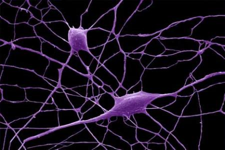 神经干细胞的基因表达的衰退和流动