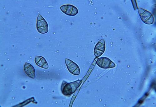 稻瘟病真菌研究揭示了植物病原真菌的毒力机制