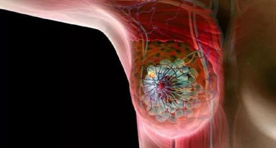 一些乳腺癌肿瘤可以阻止自己的传播