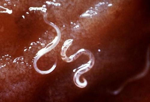 研究可以解释长期寄生虫感染的谜团