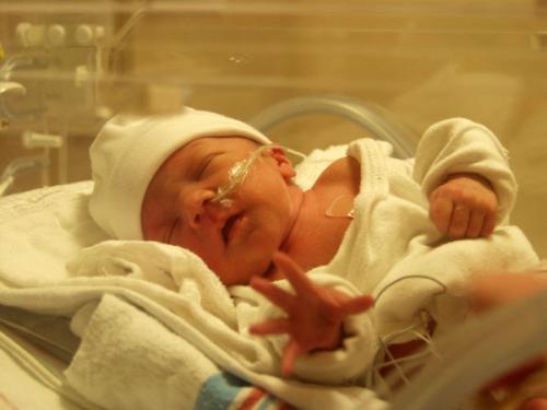 出生时非常早产或出生体重很低的人患肺病的风险很高