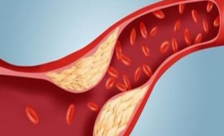 对抗凝血蛋白结构的研究可能为血栓治疗开辟新的途径