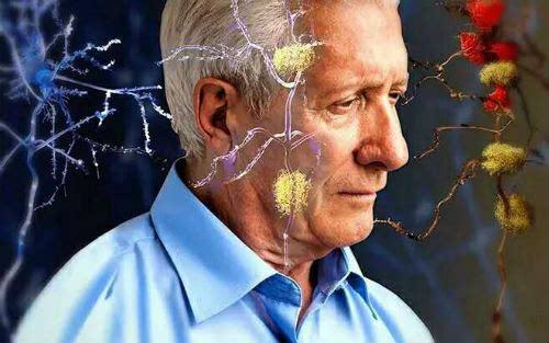 智力可以保护认知但不能预防老年痴呆症
