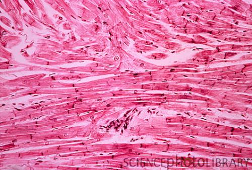 心肌细胞来自干细胞样前体细胞
