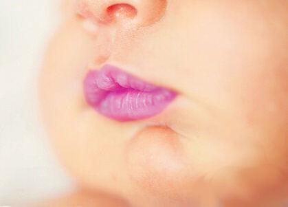 研究人员发现导致婴儿嘴唇和皮肤变蓝的罕见致命疾病的原因