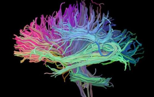 科学家们发现了开发用于医学成像的示踪剂的新方法