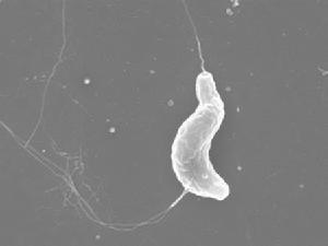 林肯大学的研究发现细菌弯曲的形状有利于运动和趋化性