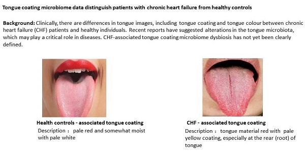 舌头微生物为心脏健康提供了窗口