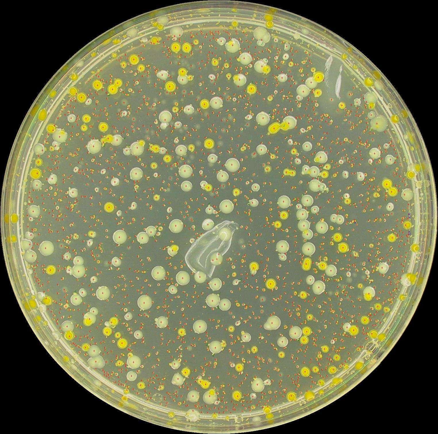 科普下假单胞菌的形态特征有哪些