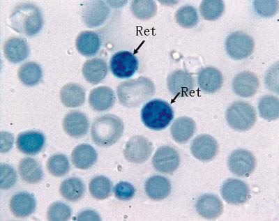 科普下网织红细胞计数的临床意义有哪些