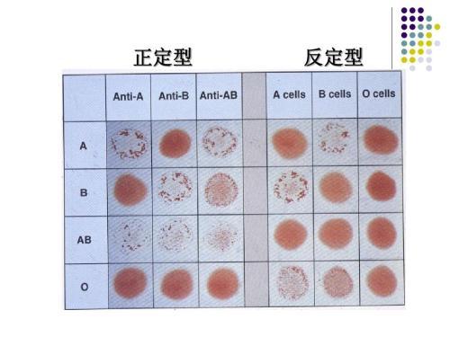 介绍下ABO血型鉴定的临床意义是什么