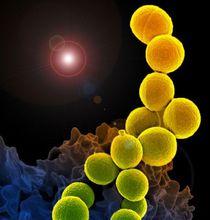 针对耐甲氧西林金黄色葡萄球菌疫苗出现的新策略
