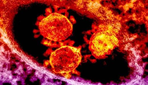斯坦福大学的一项研究发现一些病毒有助于保护CF患者的有害细菌