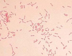 未来更严重的沙门氏菌爆发悉尼大学的研究