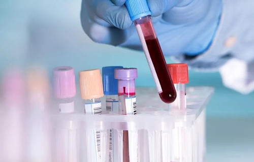 血液样本有助于为癌症患者选择合适的早期临床试验