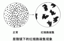 科普下间接凝集抑制反应的原理是什么