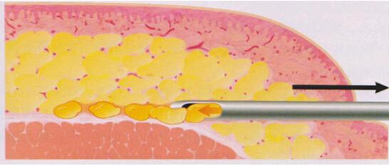 脂肪组织形成的细胞来源