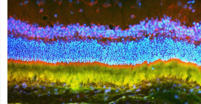 科学家使用纳米粒子传递的基因疗法抑制啮齿动物的致盲性眼病