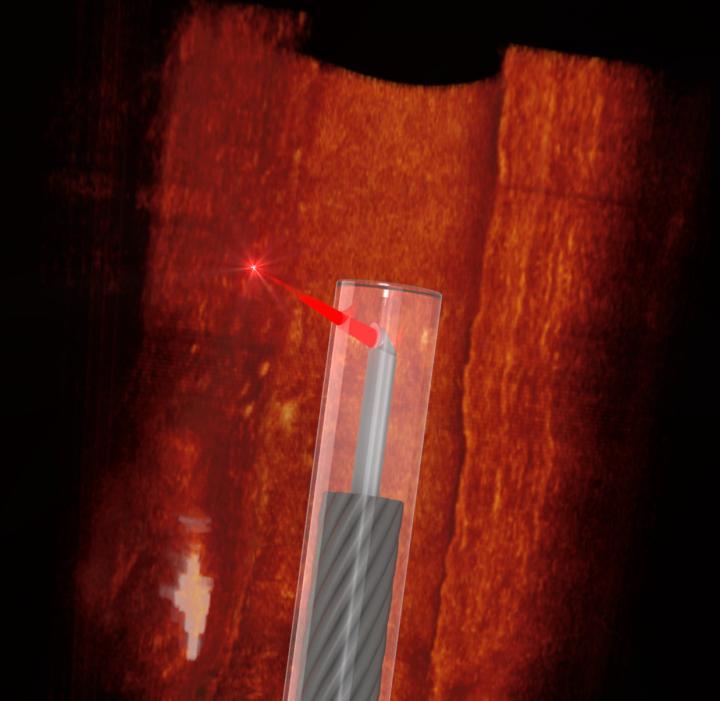 研究人员已使用3D微型打印技术开发了世界上最小的血管内窥镜
