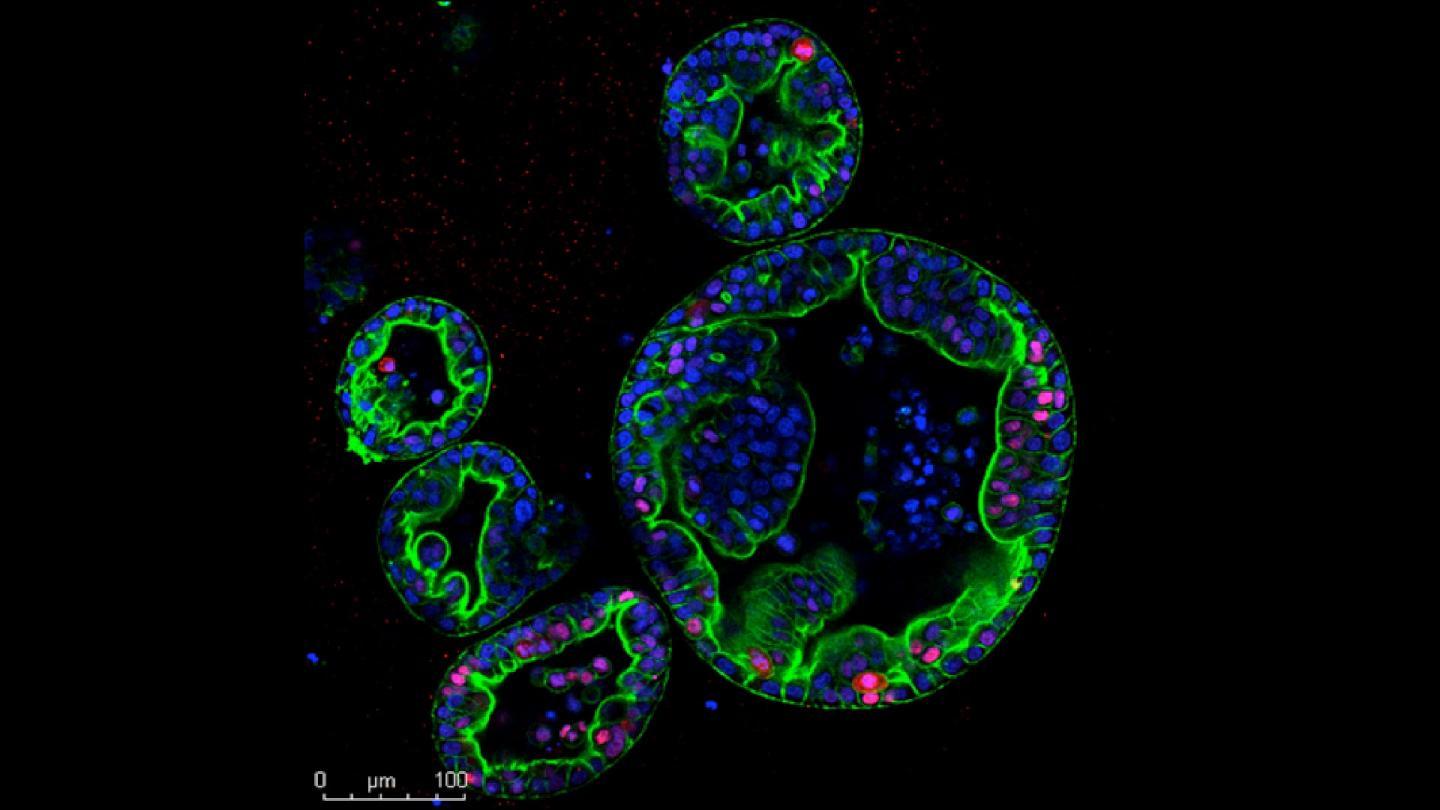 人类胰腺癌亚型的第一个小鼠模型